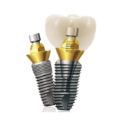 chiphitrongrangimplant